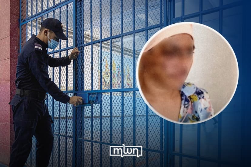 Moroccan Court Sentences Man to 15 Years for Disfiguring Ex-Wife